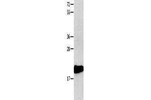 Gel: 10+12 % SDS-PAGE, Lysate: 40 μg, Lane: 231 cells, Primary antibody: ABIN7190308(CMTM3 Antibody) at dilution 1/350, Secondary antibody: Goat anti rabbit IgG at 1/8000 dilution, Exposure time: 1 minute (CMTM3 抗体)