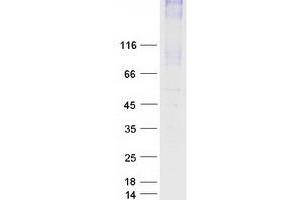 Western Blotting (WB) image for Solute Carrier Family 34 (Sodium Phosphate), Member 2 (SLC34A2) protein (Myc-DYKDDDDK Tag) (ABIN2727518)