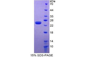 SDS-PAGE analysis of Mouse PARK7 Protein. (PARK7/DJ1 蛋白)