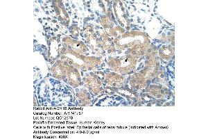 Rabbit Anti-ADH1B Antibody  Paraffin Embedded Tissue: Human Kidney Cellular Data: Epithelial cells of renal tubule Antibody Concentration: 4. (ADH1B 抗体  (C-Term))