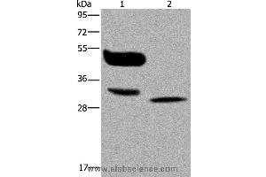 Western blot analysis of A375 cell and human lung cancer tissue, using MAGEA8 Polyclonal Antibody at dilution of 1:400 (MAGEA8 抗体)