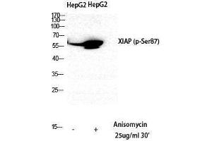Western Blotting (WB) image for anti-X-Linked Inhibitor of Apoptosis (XIAP) (pSer87) antibody (ABIN3173245) (XIAP 抗体  (pSer87))