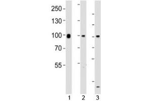 Western blot testing of Suz12 antibody at 1:1000 dilution. (SUZ12 抗体  (AA 496-530))