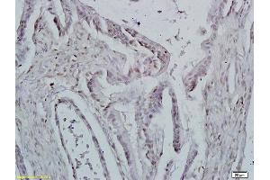Immunohistochemistry (IHC) image for anti-Inhibitor of DNA Binding 1, Dominant Negative Helix-Loop-Helix Protein (ID1) (AA 51-155) antibody (ABIN700330)