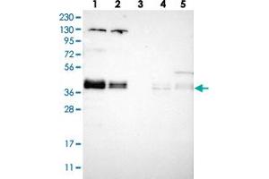 Western blot analysis of Lane 1: RT-4, Lane 2: U-251 MG, Lane 3: Human Plasma, Lane 4: Liver, Lane 5: Tonsil with ZFPL1 polyclonal antibody  at 1:250-1:500 dilution. (ZFPL1 抗体)