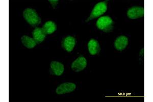 Immunofluorescence (IF) image for anti-serine/threonine Kinase 33 (STK33) (AA 1-514) antibody (ABIN566310)