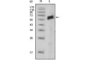 Western Blot showing AXL antibody used against extracellular domain of human AXL (aa19-444). (AXL 抗体)