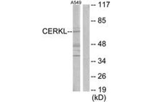 Western blot analysis of extracts from A549 cells, using CERKL Antibody.