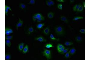 Immunofluorescent analysis of MCF-7 cells using ABIN7171879 at dilution of 1:100 and Alexa Fluor 488-congugated AffiniPure Goat Anti-Rabbit IgG(H+L) (Tetraspanin 5 抗体  (AA 114-232))