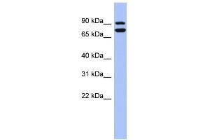 WB Suggested Anti-SOX6 Antibody Titration:  0. (SOX6 抗体  (Middle Region))