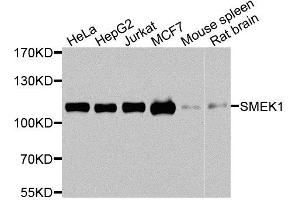 Western blot analysis of extracts of various cell lines, using SMEK1 antibody (ABIN5974870) at 1/1000 dilution. (SMEK1 抗体)