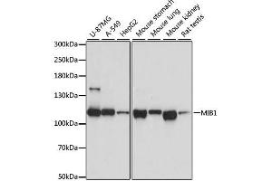 Western blot analysis of extracts of various cell lines, using MIB1 antibody. (MIB1 抗体  (AA 560-860))