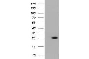 Western Blotting (WB) image for anti-Ras-Like Without CAAX 2 (RIT2) antibody (ABIN1500712) (RIT2 抗体)