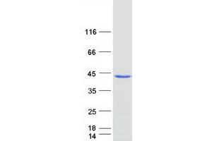Western Blotting (WB) image for Armadillo Repeat Containing 1 (ARMC1) protein (Myc-DYKDDDDK Tag) (ABIN2714921)