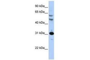 Image no. 1 for anti-Homeobox B5 (HOXB5) (AA 36-85) antibody (ABIN6741415) (HOXB5 抗体  (AA 36-85))