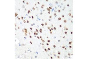 Immunohistochemistry of paraffin-embedded rat brain using CDK1 antibody. (CDK1 抗体  (AA 1-297))