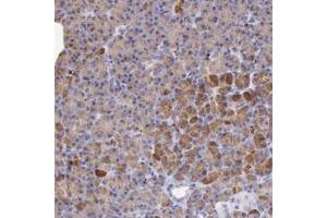 Immunohistochemical staining (Formalin-fixed paraffin-embedded sections) of human pancreas with LRFN5 polyclonal antibody  shows strong cytoplasmic positivity in glandular cells at 1:20-1:50 dilution. (LRFN5 抗体)