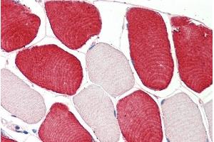 ABIN5539869 (5µg/ml) staining of paraffin embedded Human Skeletal Muscle. (MIA 抗体  (Internal Region))