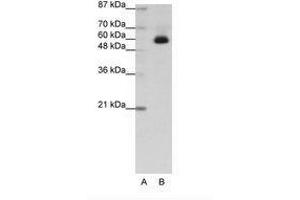 Image no. 1 for anti-Zinc Finger Protein 307 (ZKSCAN4) (C-Term) antibody (ABIN202741) (ZKSCAN4 抗体  (C-Term))