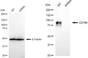Western blotting analysis using CD166 antibody (ABIN7797476). (Recombinant CD166 抗体)