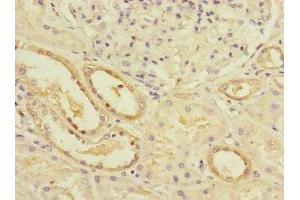 Immunohistochemistry of paraffin-embedded human kidney tissue using ABIN7163118 at dilution of 1:100 (Lipin 1 抗体  (AA 741-890))
