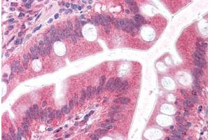Human Small Intestine: Formalin-Fixed, Paraffin-Embedded (FFPE) (Embigin 抗体  (C-Term))