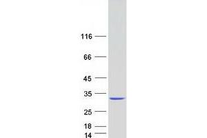 Western Blotting (WB) image for Nudix (Nucleoside Diphosphate Linked Moiety X)-Type Motif 21 (NUDT21) protein (Myc-DYKDDDDK Tag) (ABIN2712535)