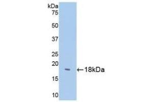 Detection of Recombinant SST, Human using Polyclonal Antibody to Somatostatin (SST) (Somatostatin 抗体  (AA 1-116))