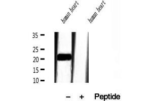 Western blot analysis of extracts of human heart tissue, using Transgelin 2 antibody. (TAGLN2 抗体  (Internal Region))