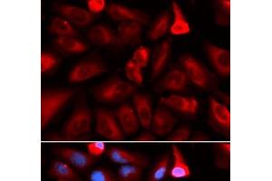 Immunofluorescence analysis of U2OS cells using FKBP4 Polyclonal Antibody (FKBP4 抗体)