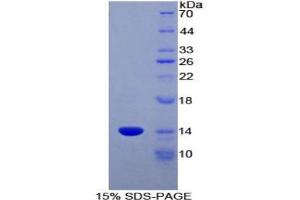 SDS-PAGE analysis of Rat CCL6 Protein. (MRP1 蛋白)