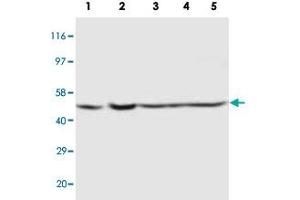 Western blot analysis of tissue and whole cell extracts with PSEN2 polyclonal antibody . (Presenilin 2 抗体  (Internal Region))