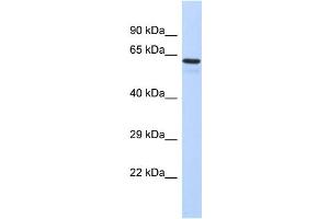 Host:  Rabbit  Target Name:  TBX3  Sample Type:  Fetal Liver lysates  Antibody Dilution:  1. (TBX3 抗体  (C-Term))