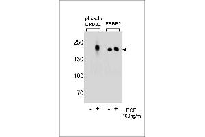 Western blot analysis of extracts from A431 cells,untreated or treated with EGF,100 ng/mL,using phospho ERBB2  (left) or ERBB2 Antibody (right) (ErbB2/Her2 抗体  (pTyr1196))