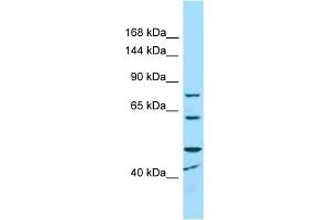 Western Blotting (WB) image for anti-Microcephalin 1 (MCPH1) (C-Term) antibody (ABIN2789648) (MCPH1 抗体  (C-Term))