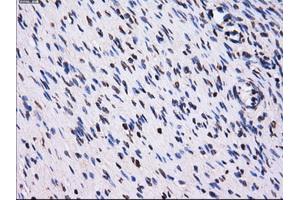 Immunohistochemical staining of paraffin-embedded Ovary tissue using anti-PPME1mouse monoclonal antibody. (PPME1 抗体)