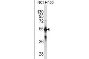 CYP2C9 Antibody (N-term)(Ascites) ABIN1882233 western blot analysis in NCI- cell line lysates (35 μg/lane). (CYP2C9 抗体  (N-Term))