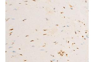 Immunohistochemistry (IHC) image for anti-Neurotrophic Tyrosine Kinase, Receptor, Type 1 (NTRK1) (pTyr681), (Tyr680) antibody (ABIN6256787)