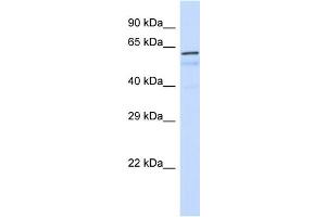Host:  Rabbit  Target Name:  FOXK1  Sample Type:  Placenta lysates  Antibody Dilution:  1. (Foxk1 抗体  (C-Term))