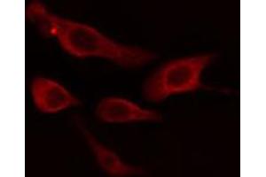 Immunofluorescence (fixed cells) (IF/ICC) image for anti-Cytochrome P450, Family 2, Subfamily B, Polypeptide 6 (CYP2B6) (Internal Region) antibody (ABIN6258099)