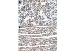 Immunohistochemical staining (Formalin-fixed paraffin-embedded sections) of human liver (A) and human heart (B) with DLX5 polyclonal antibody  at 4-8 ug/mL working concentration. (DLX5 抗体  (N-Term))