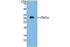 Detection of Recombinant Flt3, Mouse using Polyclonal Antibody to FMS Like Tyrosine Kinase 3 (Flt3) (FLT3 抗体  (AA 335-544))