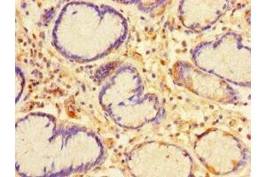 Immunohistochemistry of paraffin-embedded human stomach tissue using ABIN7146737 at dilution of 1:100