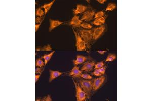 Immunofluorescence (IF) image for anti-Ribosomal Protein L23 (RPL23) (AA 1-140) antibody (ABIN1682575)