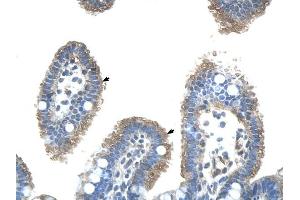 UBE2J2 antibody was used for immunohistochemistry at a concentration of 4-8 ug/ml to stain Epithelial cells of intestinal villus (arrows) in Human Intestine. (UBE2J2 抗体)