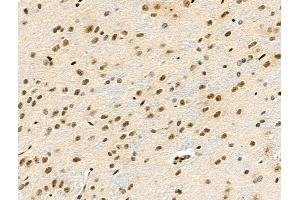 Phospho-RSK1 p90 (Thr348) Antibody at 1/100 staining Rat brain tissue by IHC-P.