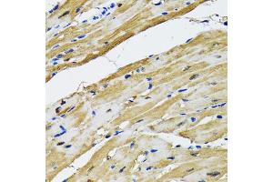 Immunohistochemistry of paraffin-embedded rat heart using GOT1 antibody (ABIN2562884) at dilution of 1:100 (40x lens). (GOT1 抗体)