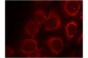 Image no. 1 for anti-SMAD, Mothers Against DPP Homolog 1 (SMAD1) (AA 461-465) antibody (ABIN319351)