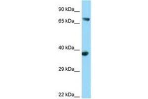 Image no. 1 for anti-FYN-Binding Protein (FYB) (AA 39-88) antibody (ABIN6748114) (FYB 抗体  (AA 39-88))