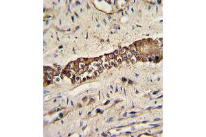 Formalin-fixed and paraffin-embedded human normal lung with TYRO10 Antibody, which was peroxidase-conjugated to the secondary antibody, followed by DAB staining. (DDR2 抗体)